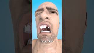 Why You Dream About Losing Teeth 🤔 Surgeon Reacts Fear Of Losing Teeth