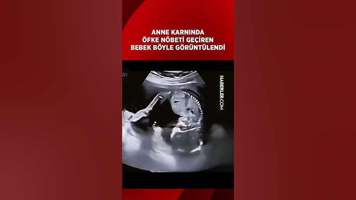Anne Karnında Öfke Nöbeti Geçiren Bebek Böyle Görünüyor