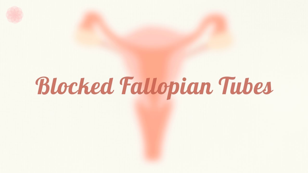How Blocked Fallopian Tubes Affect Fertility YouTube How Blocked Fallopian Tubes Affect Fertility YouTube