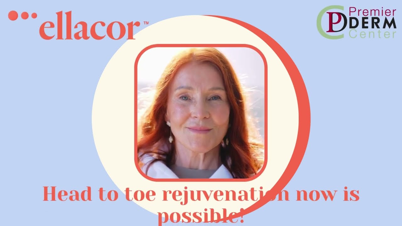 ellacor: a revolutionizing technology