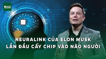 Neuralink của Elon Musk lần đầu cấy chip vào não người | BNC