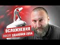 Осложнения после удаления зуба 🤕 какие бывают и почему?