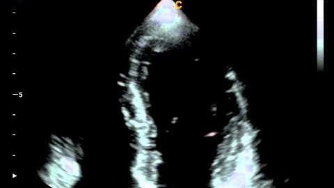 Chison Qbit CardiacB 2  Ultrasound Equipment