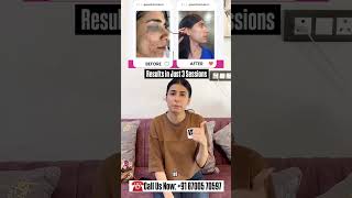 Happy client #skintreatment #beautycare #skinrejuvenation #glowingskin #aesthetictreatments