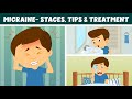 Understanding Migraines