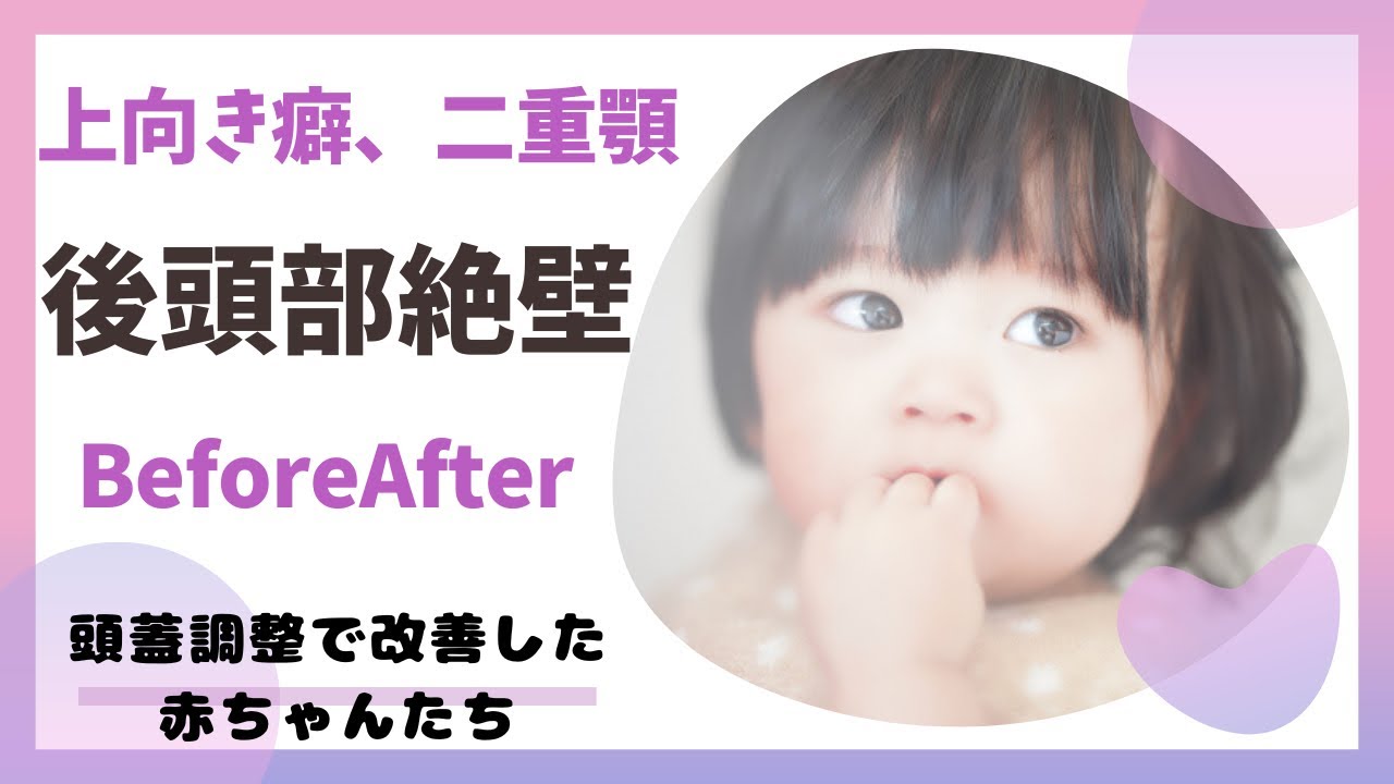 赤ちゃん 二 重 あご
