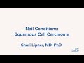 Nail Unit Conditions: Squamous Cell Carcinoma