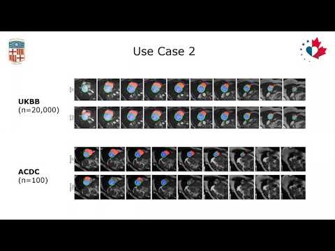 W 30 Data sharing and analytics platforms for medical imaging in the age of big data by K. Lekadir