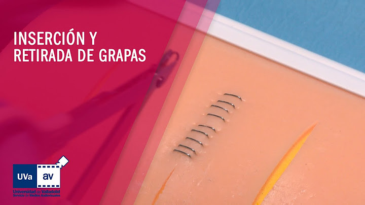 INSERCIÓN Y RETIRADA DE GRAPAS