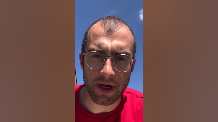 The Journey Of Going Bald (in 567.5 Days)