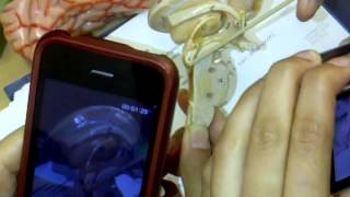 VID-20120510-00024 exam 3