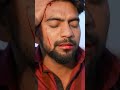 Mohit ke sar me lagi chot l Crazy XYZ#funny #experiment #food #mrindeanhacker #crazyxyznew