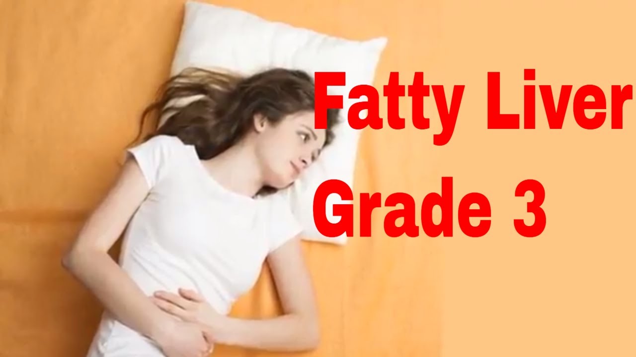 Fatty liver grade 3 youtube