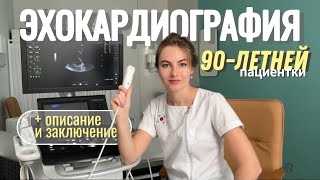 видео: ЭхоКГ 90-летней женщины. Все измерения, ОПИСАНИЕ и ЗАКЛЮЧЕНИЕ ЭхоКГ картинка: ЭхоКГ 90-летней женщины. Все измерения, ОПИСАНИЕ и ЗАКЛЮЧЕНИЕ ЭхоКГ