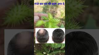 गंजेपन को खत्म कर नए बाल उगाए | Hairfall control home remedy | ganjapan ka ilaj #shortvideo #shorts