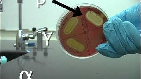 Identifying hemolysis.