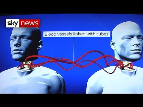 Video: A Trial Head Transplant Operation Was Performed - Alternative View