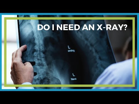 Do I Need an X-Ray Before Starting Physical Therapy?