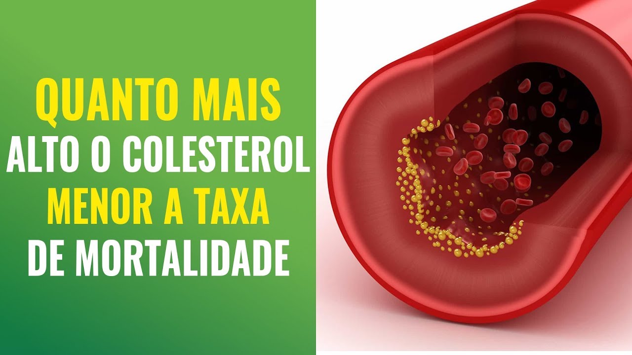 colesterol alto acima de 200 colesterol alto acima de 200