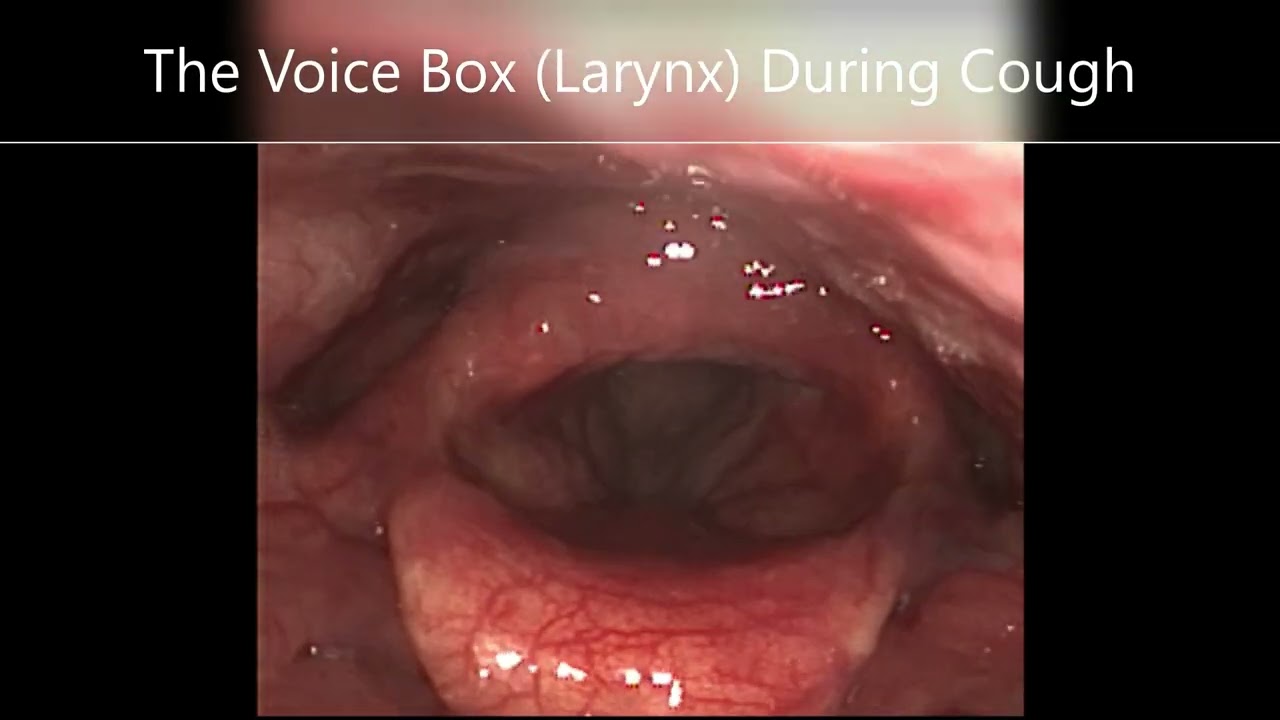 chewing tobacco throat cough What can dipping and do to your body? 5 things to know Sucrets Throat Lozenges Cough Control