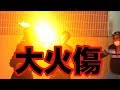 【大惨事】炎のビンタと水風船！！熱い？冷たい？！