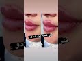 فلر شفه 