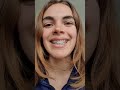 How to wear a metal retainer #braces #short #shorts #smile #howto #adultbraces #teeth