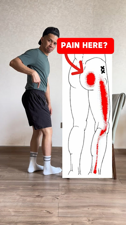 Pain in your buttock? Try this stretch and let me know how it goes!#piriformissyndrome #sciatica