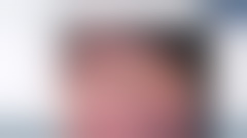 Extended anterolateral approach to the proximal humerus