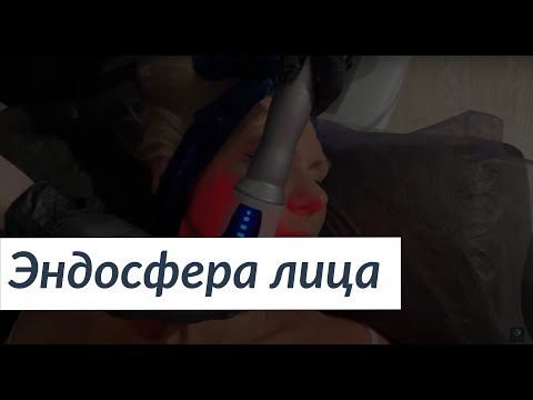 Эндосфера лица