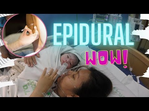 Video: Paano Ibinibigay Ang Mga Epidural