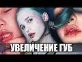 Я УВЕЛИЧИЛА ГУБЫ / последствия