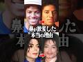 マイケルジャクソンの鼻が崩れた本当の理由