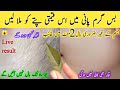 The magic of bay leaves 😱Facial hair disappears in minutes | 100% natural hair removal | Facial hair