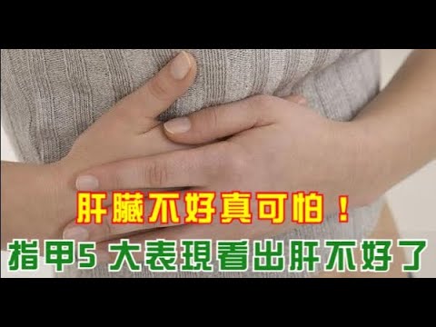肝臟不好真可怕！指甲5大表現看出肝不好了，教你2招輕鬆護肝！