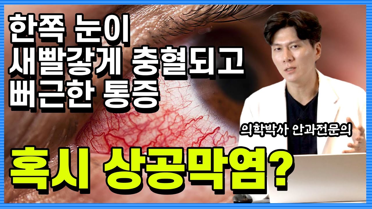 [Сонгмо Жин Нүдний эмнэлэг] Нүд чинэрч, улайж цус хурсан үед! Магадгүй эписклерит үү? [Анагаах ухааны доктор Пак Жин Хён, Захирал эмч]