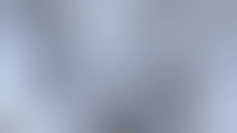 Tibial Tubercle Osteotomy and Lateral Release