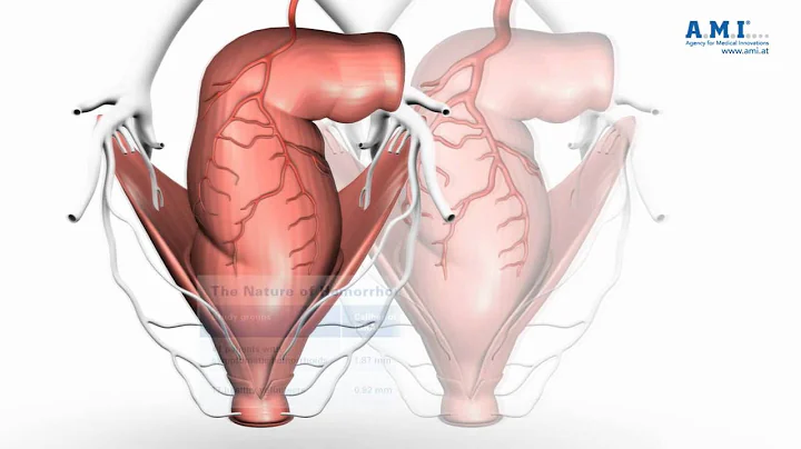 piles: nature of hemorrhoids - understanding haemo...