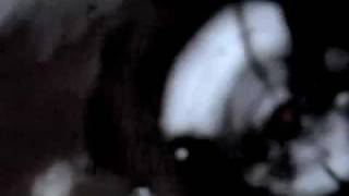 Burn Out Syndrom - Artview For Iphone