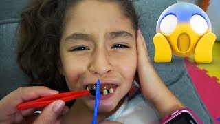 LE SALE CARIES POR COMER MUCHOS DULCES Y NECESITA UN DENTISTA URGENTE | LA CARIES v2 \/\/ YESLY