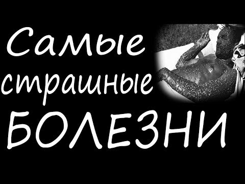 Самые страшные болезни