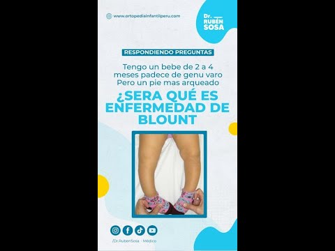 Vídeo: Com és de freqüent la mal altia de Blount?