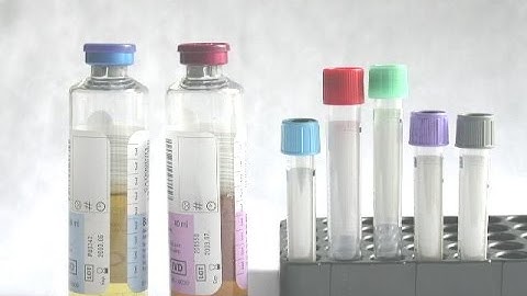 The Order of Draw: Why You MUST Follow It.