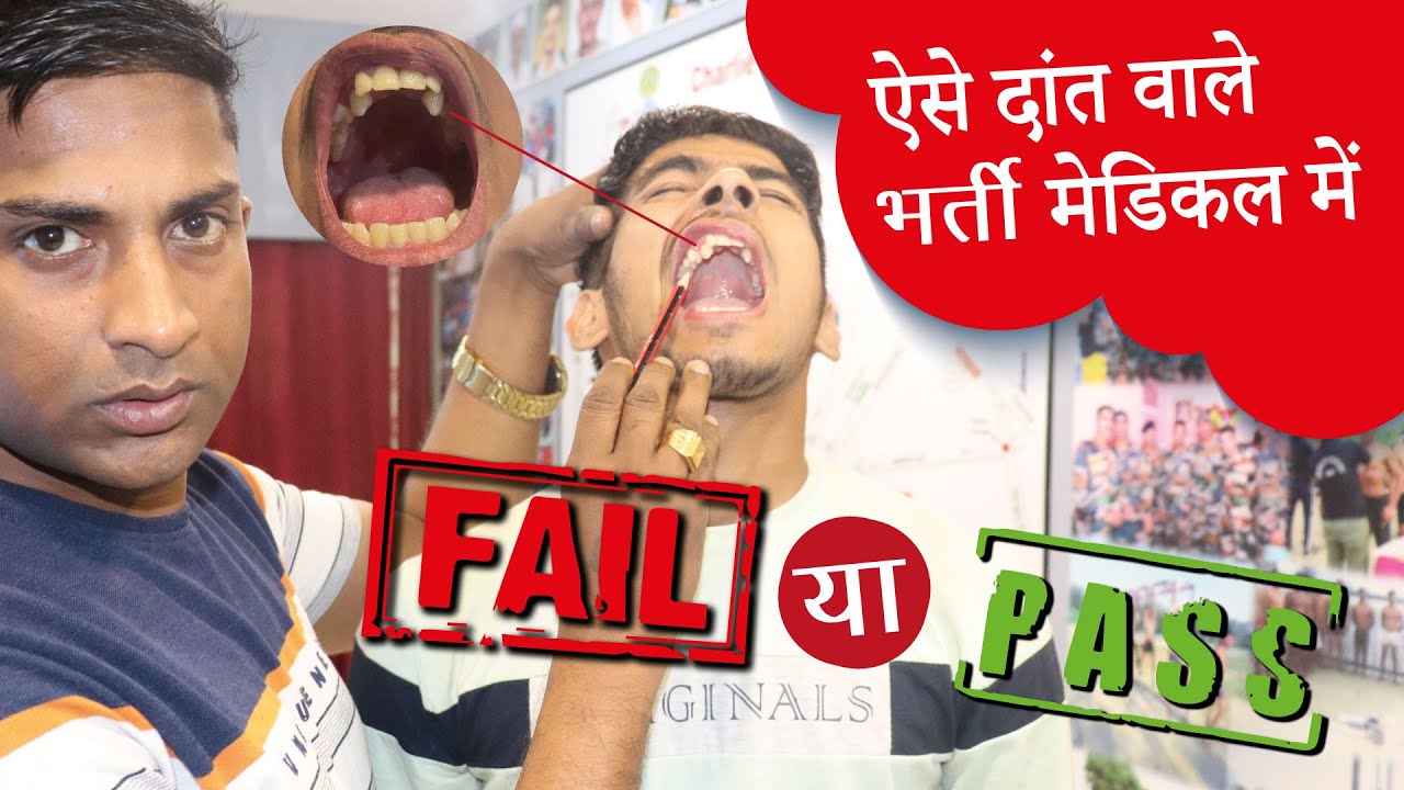भर्ती होना होगा मुश्किल | Fail या Pass | आर्मी में दांतों की जाँच कैसे होती है | Dental Checkup Army