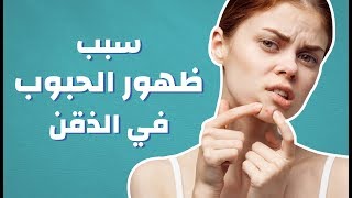 سبب ظهور الحبوب في الذقن #موضوع