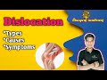 Dislocation|Types, cause, symptoms, treatment|Musculoskeletal disorder|MSN #nursing#medicaleducation