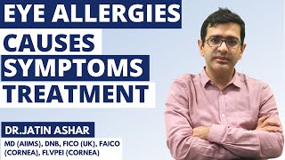 Eye Allergies | Causes & Symptoms of Eye Allergies | Drops & Treatment for Eye Allergies