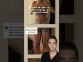 Lymphedema Leg Swelling 