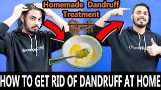 How To Get Rid Of Dandruff At Home | Homemade Dandruff Treatment | Asad Ansari
