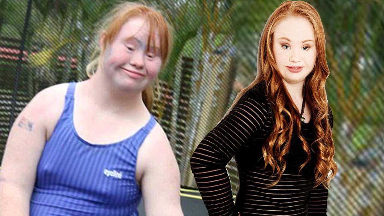 InformOverload, iOTrendz, MostAmazingTop10, Madeline Stuart, down syndrome,...